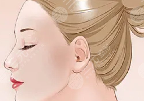 50岁面部提升做什么好