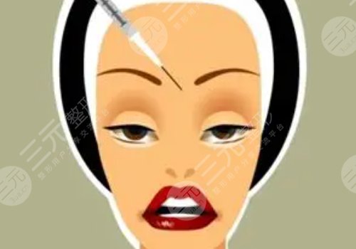 瑞蓝玻尿酸打在哪个部位?