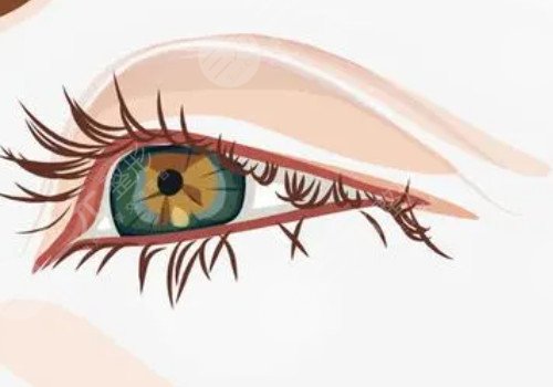 肿眼泡做双眼皮埋线好还是割好？