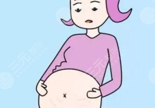 腹部拉皮手术有疤痕吗