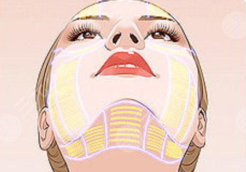 下颌角宽大是什么脸型