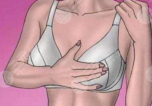 微调和整容的区别