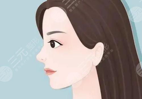 垫鼻基底前后对比照