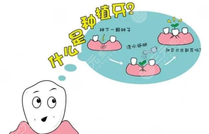 长庚医院口腔科种植牙多少钱一颗