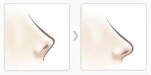 常州二院美容整形科热门项目