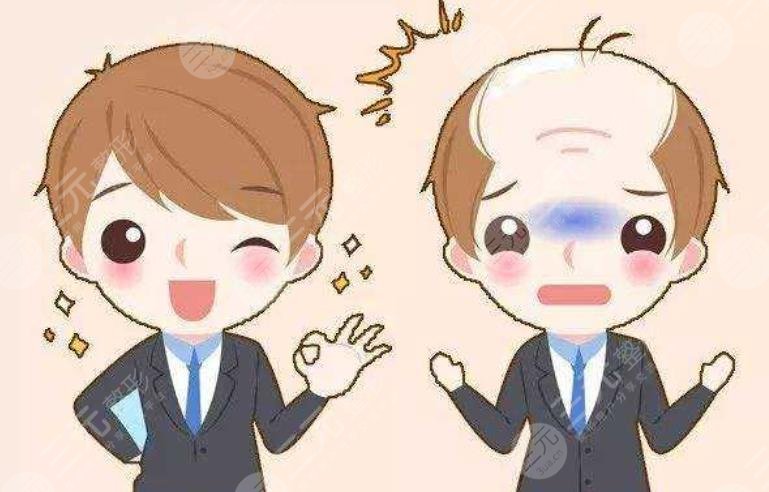 上海中山医院植发多少钱