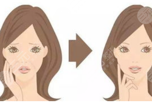 黑金dpl超光子嫩肤和m22区别