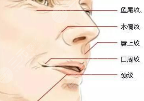 黑金dpl超光子嫩肤和m22区别