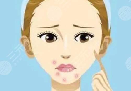 口周围长痘痘是什么原因