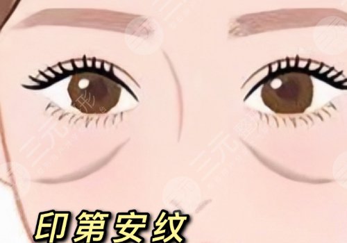 印第安纹和泪沟的区别是什么？