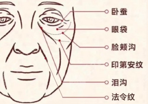 印第安纹和泪沟的区别是什么？
