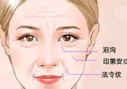 印第安纹和泪沟的区别是什么？