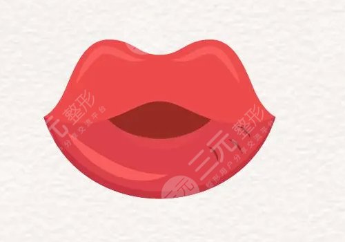 唇部填充用脂肪还是玻尿酸?
