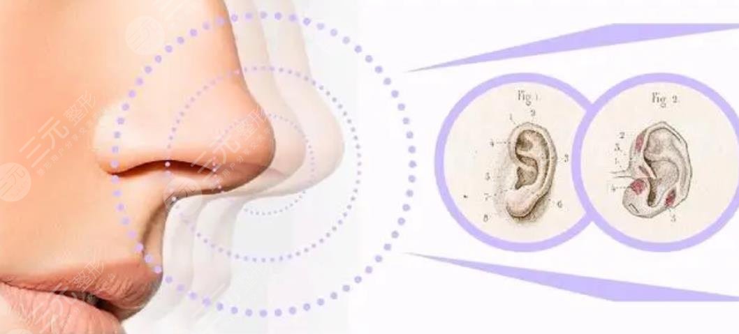 北医三院整形科隆鼻案例