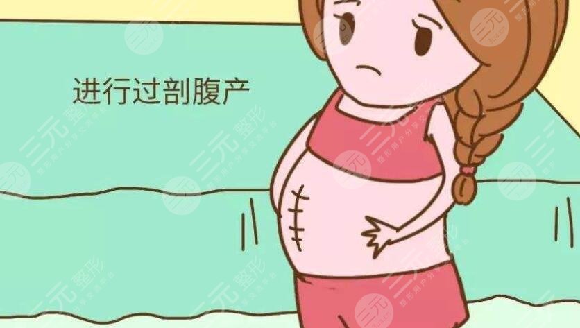 剖腹产疤痕