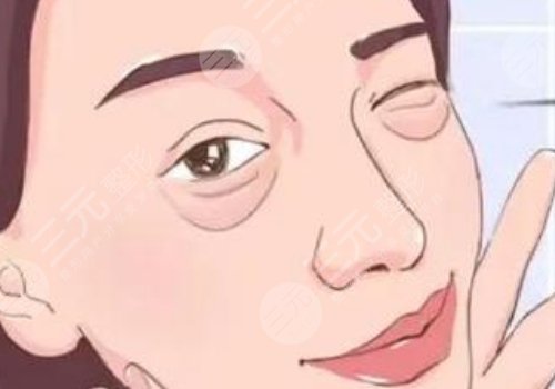 面部整形后遗症有哪些?