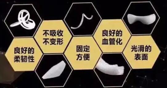 超肋骨鼻是异体骨吗？假体材料科普，优点分析！