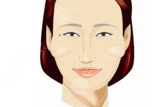 颧骨高怎么改良脸型？