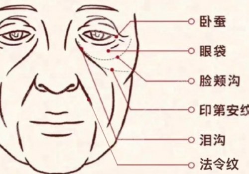 印第安纹填充胶原蛋白和玻尿酸哪个好？