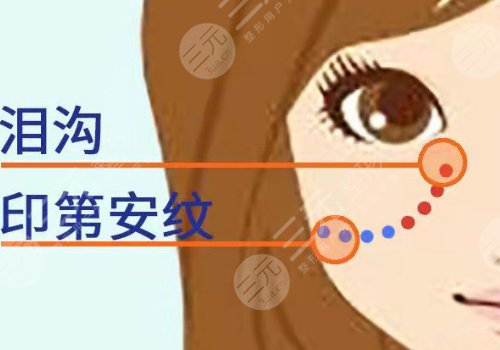 印第安纹填充胶原蛋白和玻尿酸哪个好？