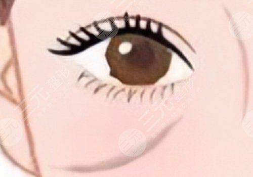 印第安纹填充胶原蛋白和玻尿酸哪个好？