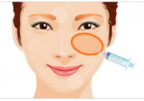 颧骨高有什么办法改良？