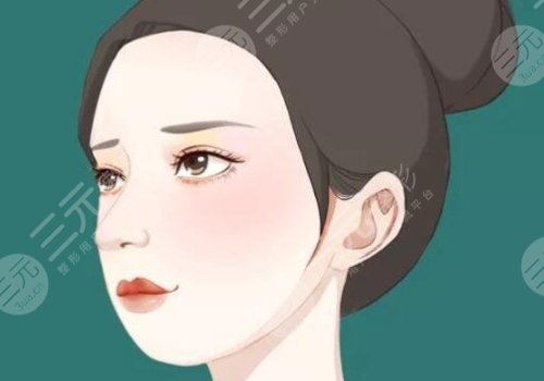 颧骨高有什么办法改良