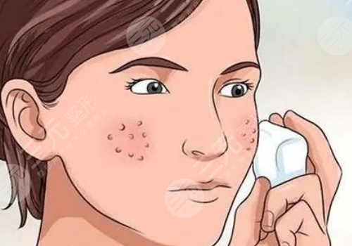 面颊毛孔粗大怎么办？