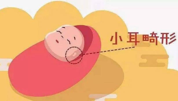 耳朵做整形注意什么问题？术前必看科普，耳畸形修复价格表分享！