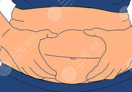 腹部拉皮手术风险大吗