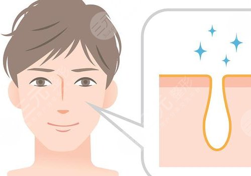 t区反复长痘痘的原因是什么？