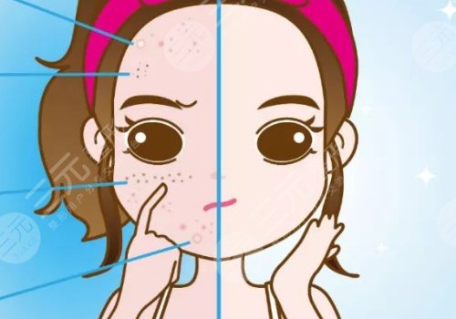 t区反复长痘痘的原因是什么？