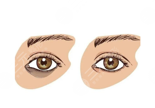 卧蚕填充用什么填好？