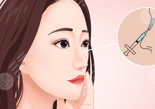 宝尼达隆鼻可以维持多久?