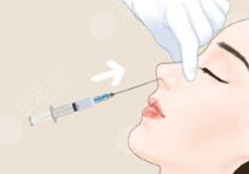 宝尼达隆鼻可以维持多久?