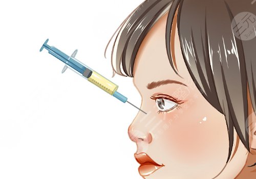 宝尼达隆鼻可以维持多久?