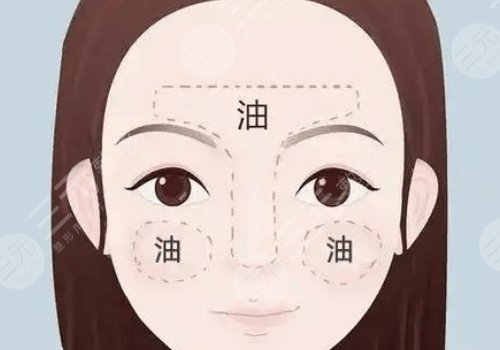 t区出油毛孔粗大什么原因？