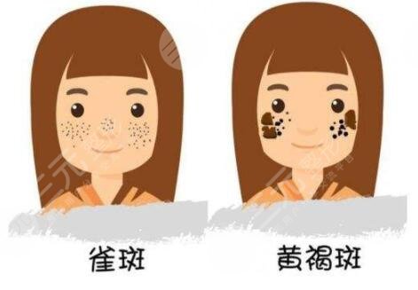 上海九院祛斑能完全去掉吗?