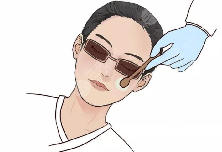 上海九院整复科光子嫩肤案例分享