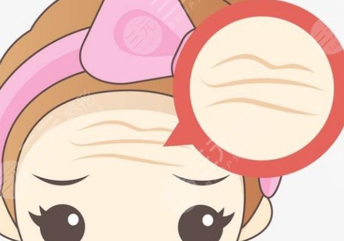 抬头纹去除手术需要多少钱?