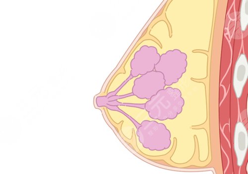 哪种胸型更好看？