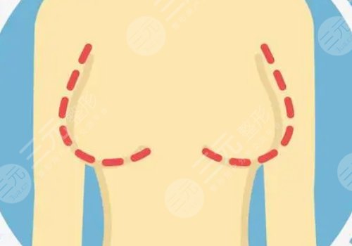 哪种胸型更好看？