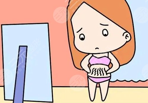 腹部拉皮手术多久能恢复正常？