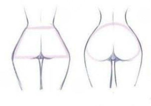 假体丰臀需要多少钱？