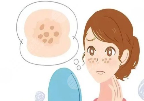 脸颊两侧长斑是什么原因？