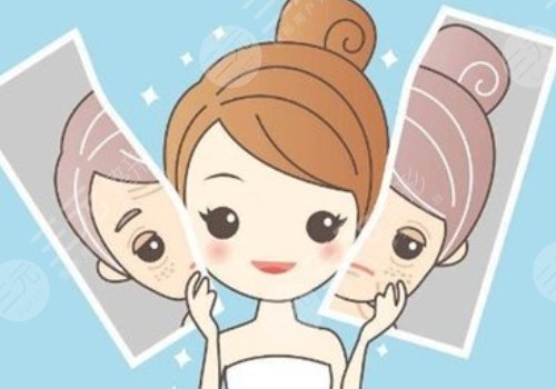 脸颊两侧长斑是什么原因？