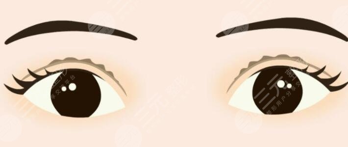 中国医学科学院整形科双眼皮案例