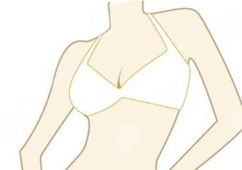 胸型不好看可以调整吗？