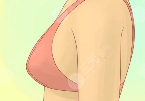 胸型不好看可以调整吗？