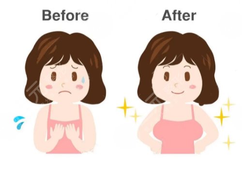 郑州天后王永功隆胸怎么样?